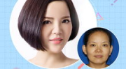 私密部怎么变紧致,重塑紧致与自信